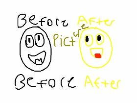 Before After Pictures