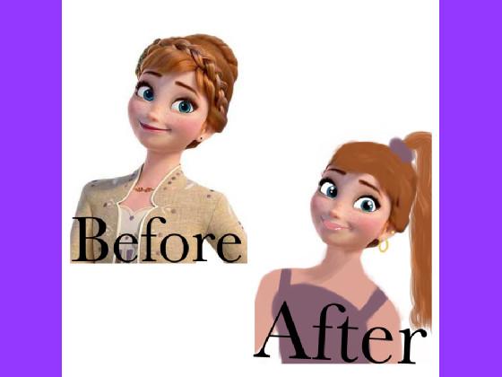 before and after anna