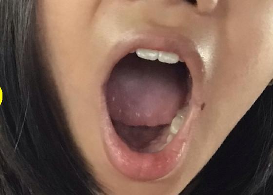 My sister’s mouth