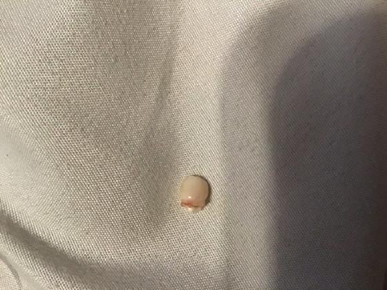 my tooth came out!!!