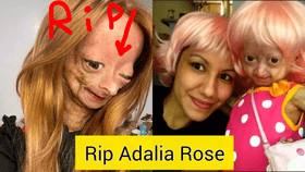 Adalia Rose