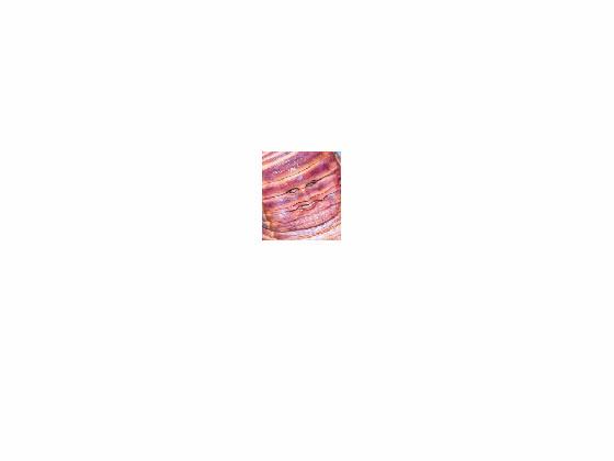 bacon