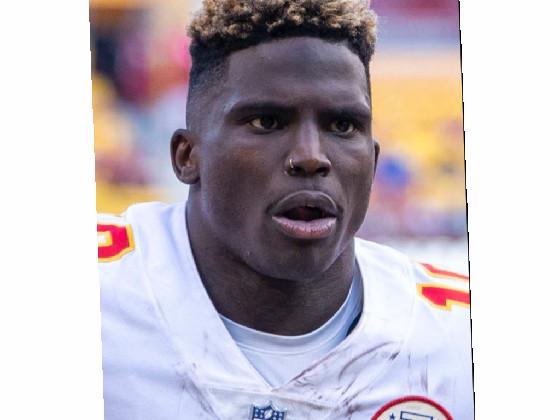 Its tyreek hill boys! 1